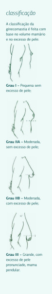 Classificação da Ginecomastia