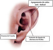 Anatomia da orelha de abano