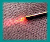 Laser da lipoaspiração