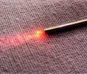 Lipoaspiração a Laser