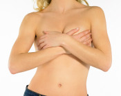 Mamoplastia Redutora