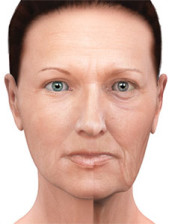 Envelhecimento da face