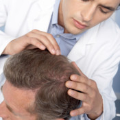 Conheça as etapas da cirurgia de implante capilar