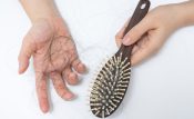 Mitos e verdades sobre a calvície feminina
