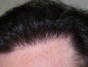 linha anterior